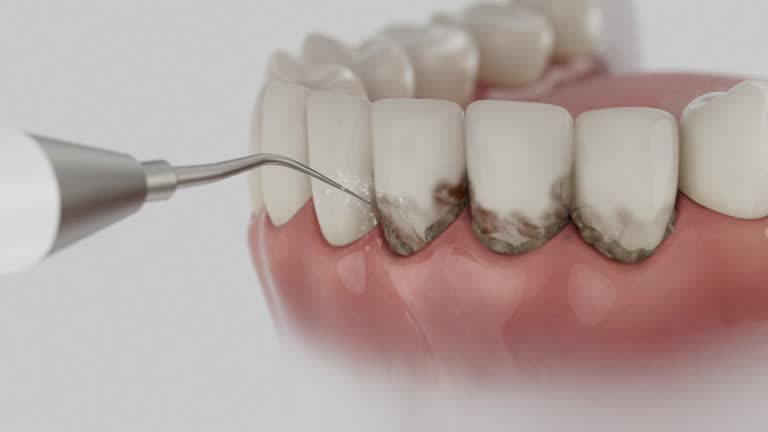 Reliable Dental contractor in Hauser, ID by Smile Center Dentistry